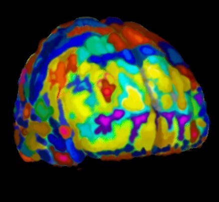 3D brain image 01 - BM&L collection