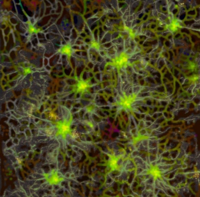 Astrocytes 01 - BM&L collection