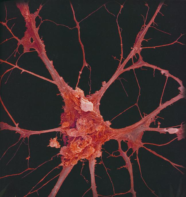 VVG SPL Activated cortical neuron - BM&L collection 