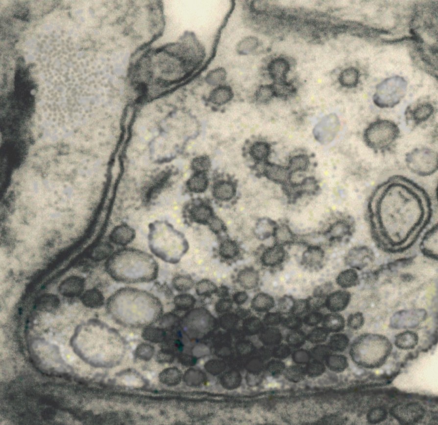 A Synapse without dinamin 1 - BM&L collection